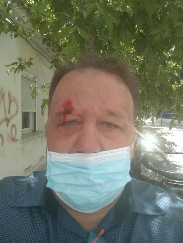 Ο δημοσιογράφος Πάνος Γαρουφαλιάς με χτύπημα στο κεφάλι