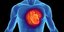 Θνησιμότητα απο καρδιακή προσβολή απειλεί τους ασθενείς και φορείς του AIDS