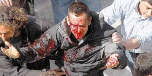 Οι δράστες φώναξαν «μπάτσοι» και επιτέθηκαν με μανία στον ειδικό φρουρό