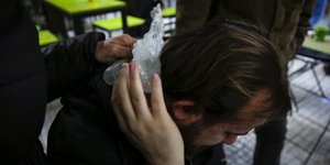 Φωτορεπόρτερ τραυματίστηκε στα επεισόδια (Φωτογραφία: EUROKINISSI/ΣΤΕΛΙΟΣ ΜΙΣΙΝΑΣ)