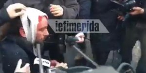 Ο φωτορεπόρτερ που τραυματίστηκε στο κεφάλι